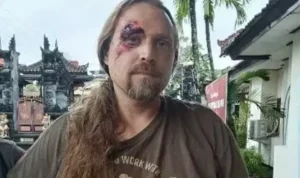 Image Credit Beritabali - A foreign national from Canada, Christopher Boyd Young, was arrested by the police after an accident in Denpasar, Bali, January 30, 2025
